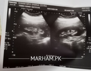 Intense Kidney Pain.