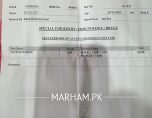 Testosterone Lavel