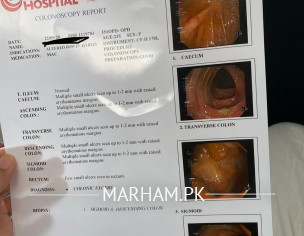 Gastrointestinal Problem