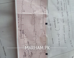 Breathing Shortage Difficult