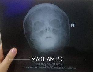 Breathing Difficulty