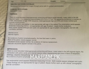 Palpable Mass At Supra Pubic Region