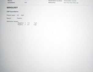 Backbone (Mohra Gap, Disc Break)  