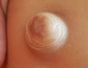 Belly Button Problem