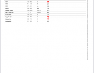 Saturation Drop During Walking