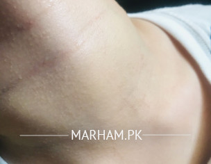 Itchy Skin