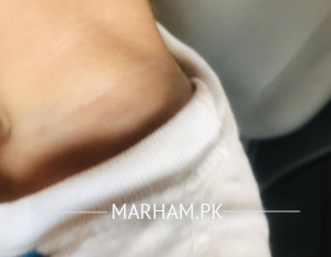 Itchy Skin