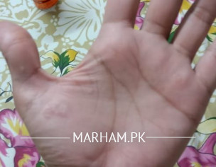 Marks On Hand