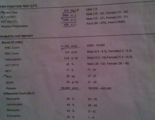 Acute Hepatitis(jaundice)