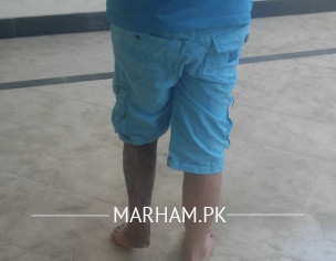 Microsurgery, Free Flap Surgery,plastic Surgery 