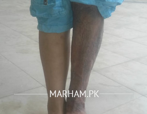 Microsurgery, Free Flap Surgery,plastic Surgery 