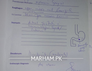 Diarrhea And Constipation