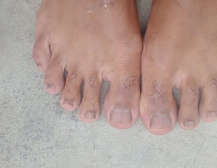 Dermatology