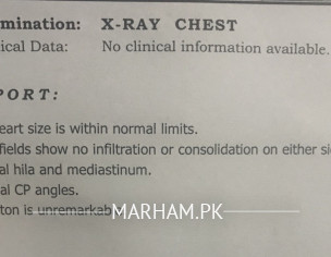 X Ray Report 