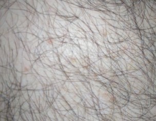 Dizziness &amp; Stomach Issues