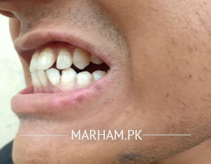 About Teeth Checkup Suggestion