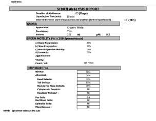 Headaches During Ovulation 