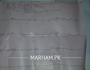 Cardiologist ECG Report