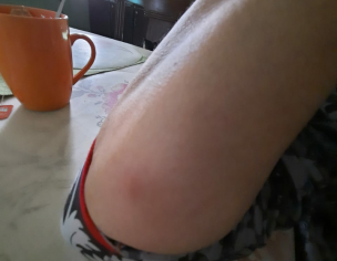 Dermatological Problem