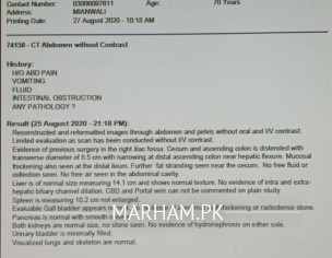 Rt Hemicolectomy, Ilecolic