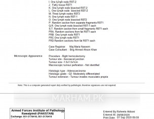 Rt Hemicolectomy, Ilecolic