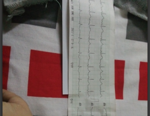 Ecg Report
