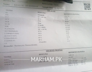 Report Result Check