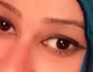 Eye Squint After Dlvry