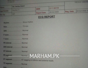 ECG Report