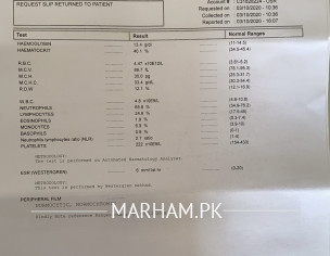 Severe Acne, High Testosterone 