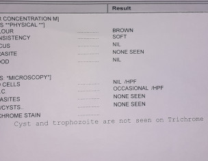 Acidity,gas And Bloating