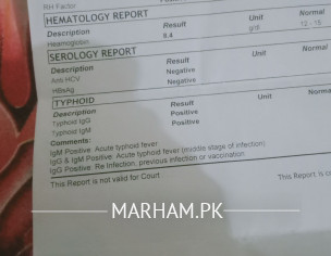 After Miscarig Test Report