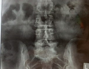 Orthopaedic: Tailbone Issue