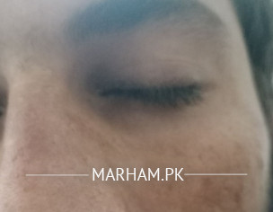 Skin Problem For Long Time