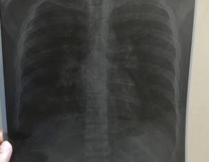Pulmonology