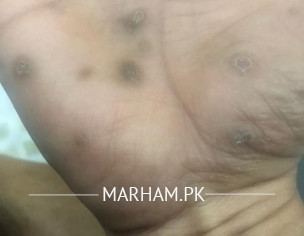 Skin Problem