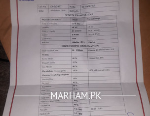 My Sperms Count 5% Please Help