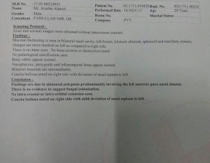 Doctor Suggested Surgery