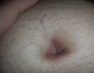 Belly Button