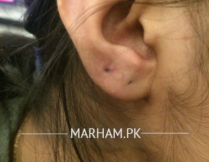 Second Ear Piercing