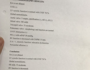 Heart Echocardiography 