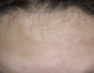 Skin Issue