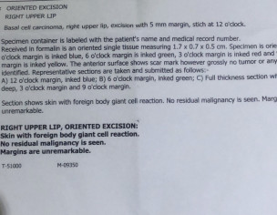 Basal Cell Carcinoma 