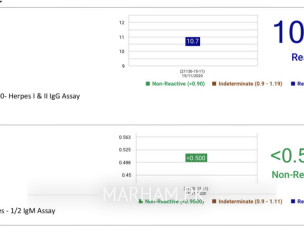 HSV IgG Came Out Reactive 