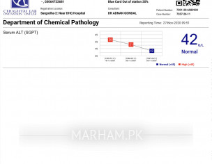 Alt Sgpt After Typhoid