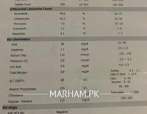 Alt Sgpt After Typhoid