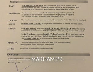 Alt Sgpt After Typhoid