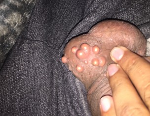 Dannay On My Testies