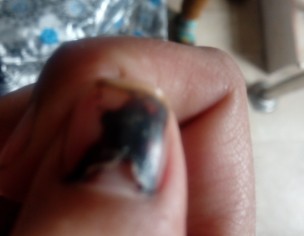 Damaged Nail