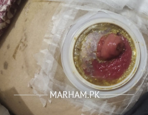 Wound/rashes Under Stoma